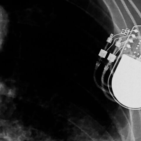 medicaldevice_resources_hero_bw_