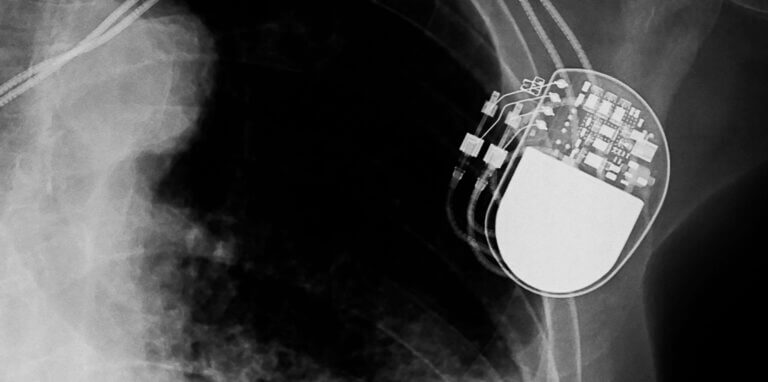 4 Scenarios When High Risk Devices May Be Exempt from Mandatory Clinical Investigations Under EU MDR