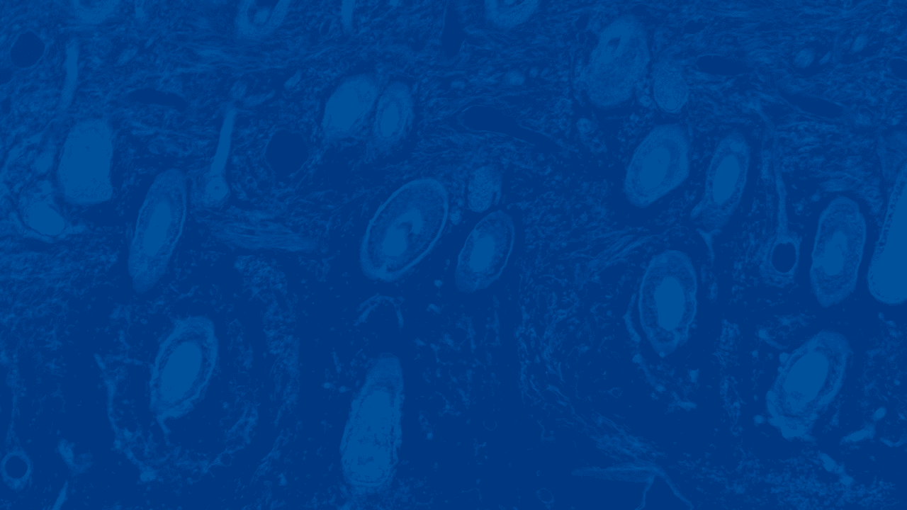 Addressing the Top 7 Challenges in Decentralized Dermatology Trials