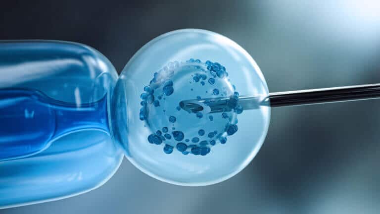 IVF