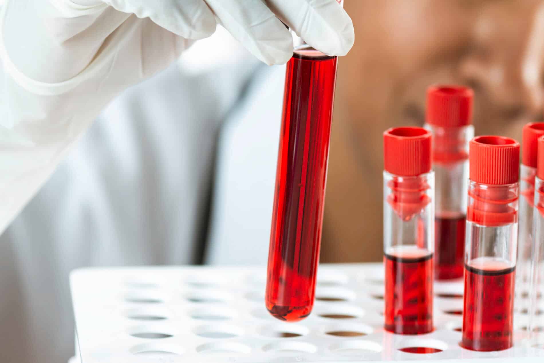 Is Your Lab Ready? Complying with FDA’s Final Rule on LDTs, Stage 1